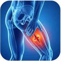 Relief Plan – Targeted Steroid Injection – Image 6