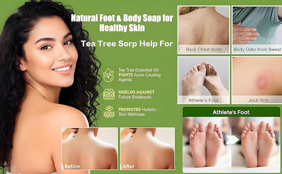 3 pieces Tea Tree Anti-fungal Soap Bar – Purifying Face & Body Soap – Image 7