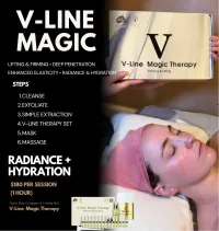 V-Line Magic – Image 1