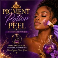 Pigment Potion Peel (Hyperpigmentation) – Image 1