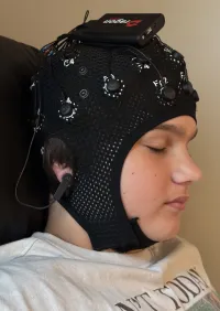 qEEG Brain Map – Image 2