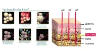 Buy 6, get 6 FREE- 5D Lipo Laser – Image 14