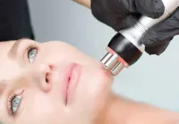 3- RF Skin Tightening Facials  – Image 3