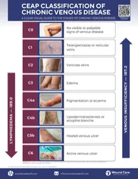 Guide: CEAP Classification of Chronic Venous Disease – Image 2