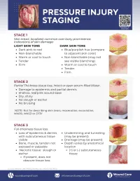 Guide: Pressure Injury Stages – Image 3