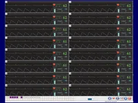 [A00167904] - CSS Central Station Software per monitor multiparametrici [UP700/K12/K15] Gima – Image 1