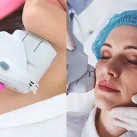 HIFU Facial + Neck – Image 1