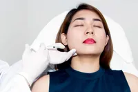 Facial Botulinum Toxin (Botox) Treatment – Image 1