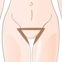 Bikini – Imagen 1