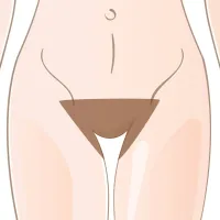 Brazilian Depilación Láser Ella – Imagen 1