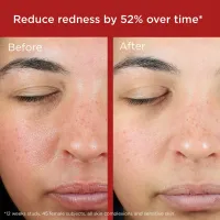 EltaMD UV Skin Recovery Broad Spectrum SPF 50 Face Sunscreen. 1.7 oz – Imagen 1