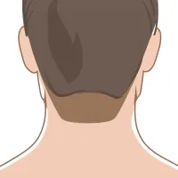 Oferta Especial Depilación Láser (El) – Nuca