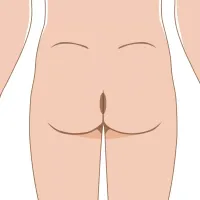 Perianal (Él) – Imagen 1