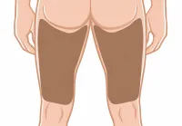 Muslo Posterior (Él) – Imagen 1