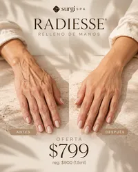 Oferta especial Radiesse · Ella – Imagen 1