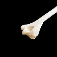 Humerus – Image 3