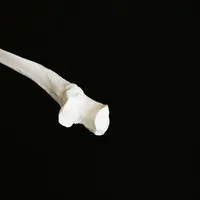 Ulna – Image 3