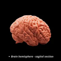 Nervous System – Set of 5 Models – Image 3