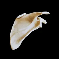 Upper Limb – Complete Set – Image 2