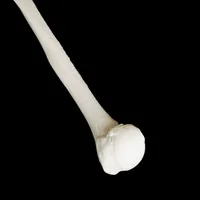 Humerus – Image 2