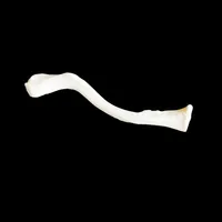 Clavicle – Image 1