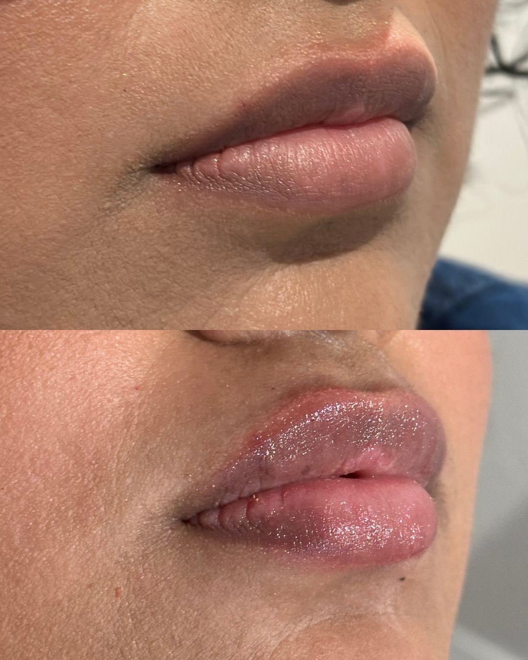 Lip Flip – Image 2