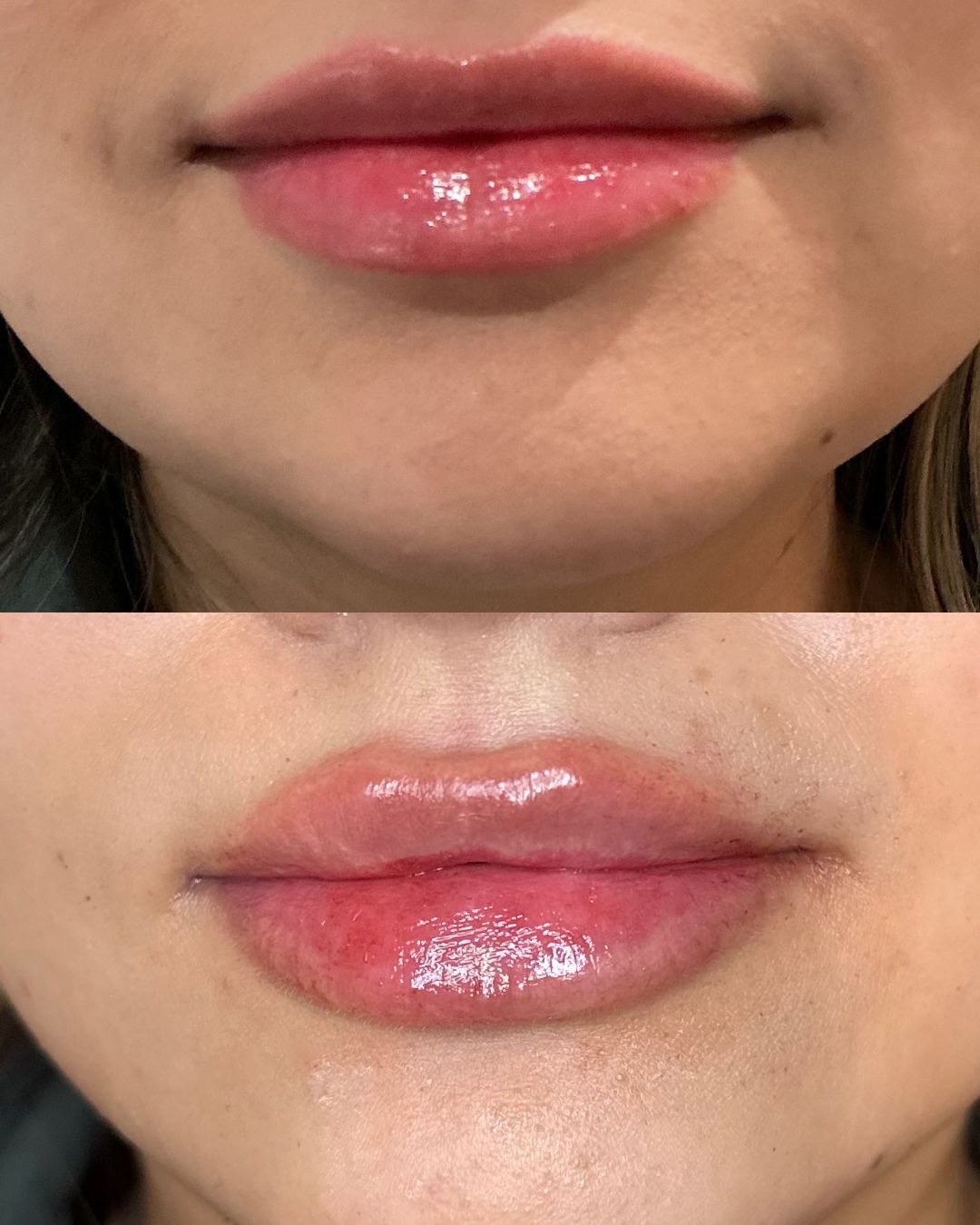 Lip Flip – Image 3