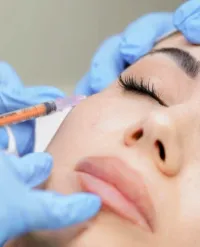 Botox Classico – Trattamento Rughe Viso – Image 1