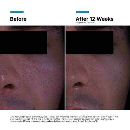 P-TIOX Anti-Wrinkle Cream – Image 4