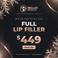 Full Lip Filler – Image 1