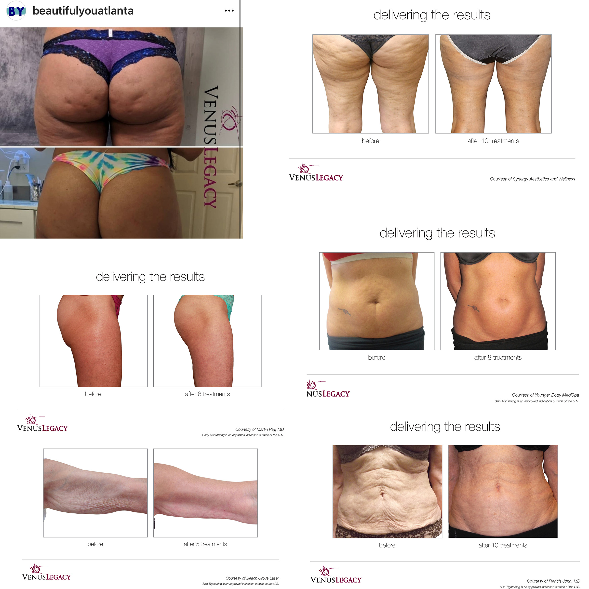 Package- Venus Legacy 5 pk  – Image 2