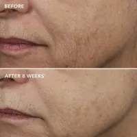 Masque de nuit au rétinol AGELESS+ Complexe de rétinol 0,5% – Image 2