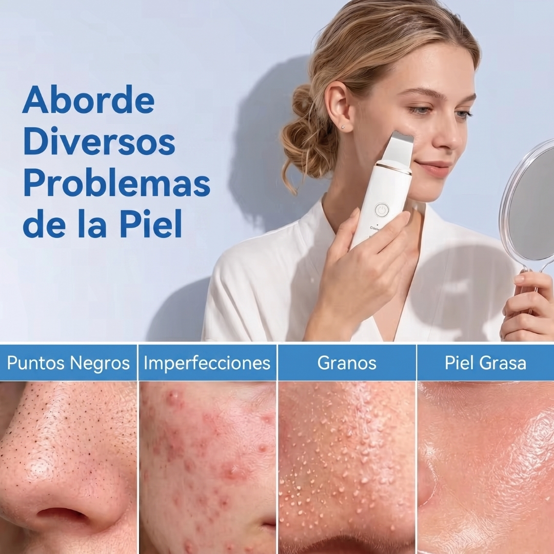 Removedor ultrasónico de piel muerta – Image 3