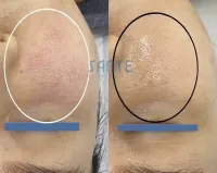 Soother Peel Serum (Dr Sante) – Image 2