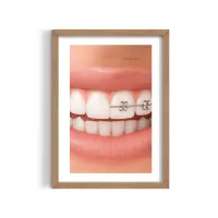 Cuadro Sonrisa Radiante – Estilo Fotografía Conceptual Estética – Haya medio, 30x40cm