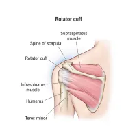 Shoulder Injury First Aid – Image 2