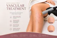 3 Sessions - Spider Veins Removal – Image 2