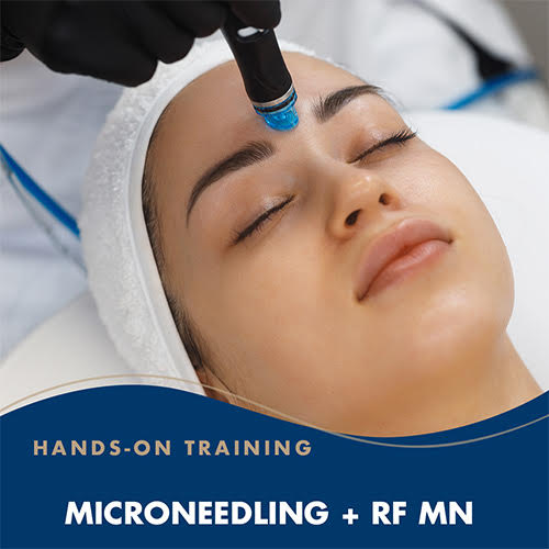 MICRONEEDLING AND RF MICRONEEDLING W/ STEM CELLS & EXOSOMES – Image 1