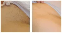 Beach Body Bundle: Brazilian + Full Legs – Image 3