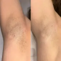 Underarms Package of 6 – Image 2