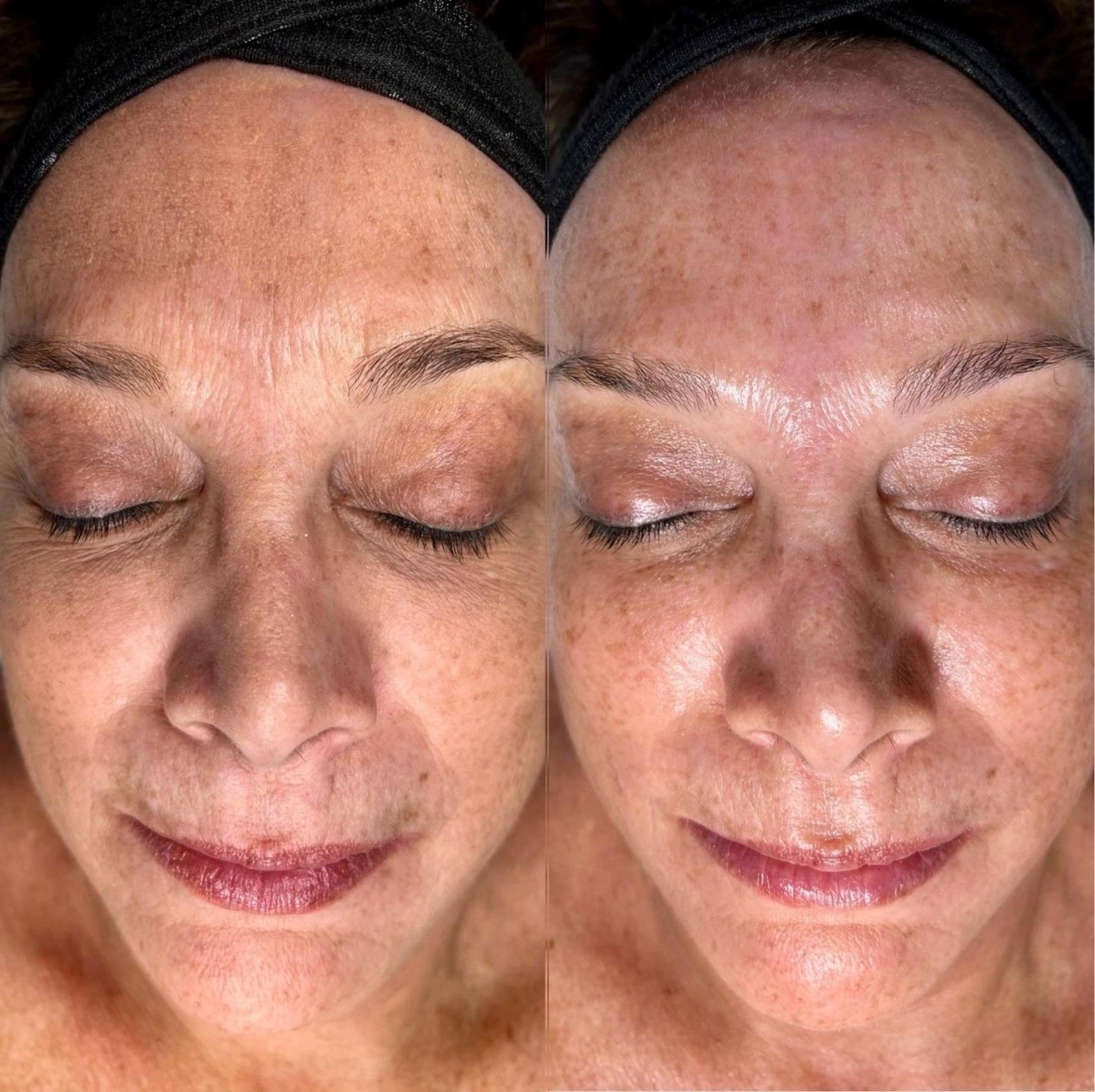 Glow Starter Facial – Image 3
