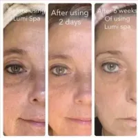 LumiSpa iO + Cleanser – Image 4