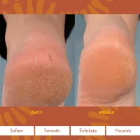 Sole Solution – Image 2