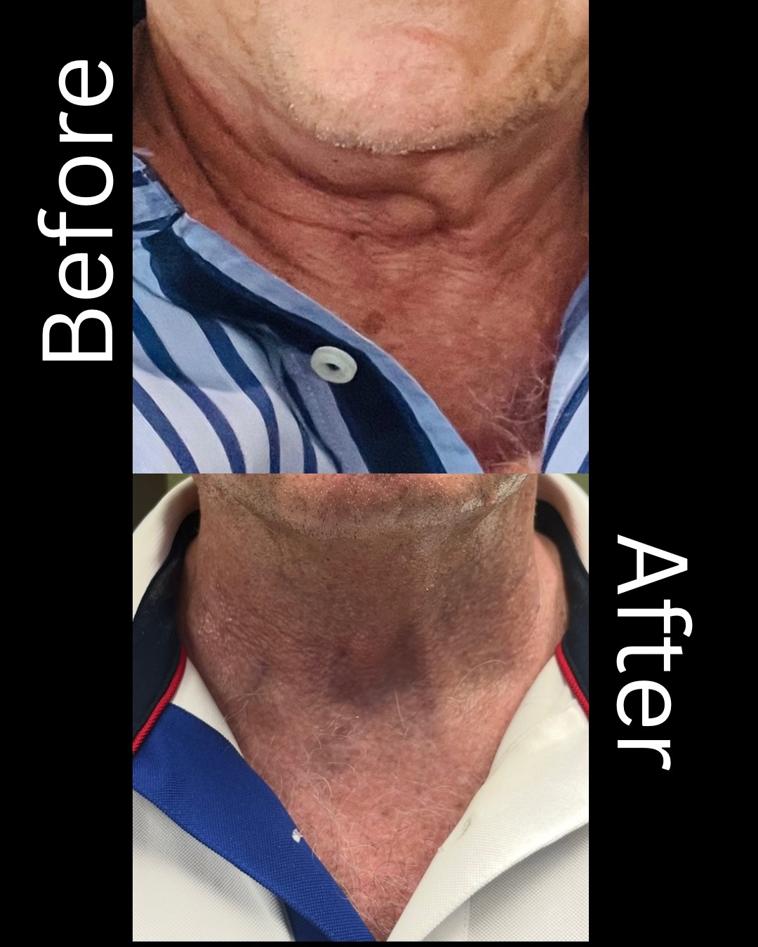 Professional Face/Neck Cream – Image 4