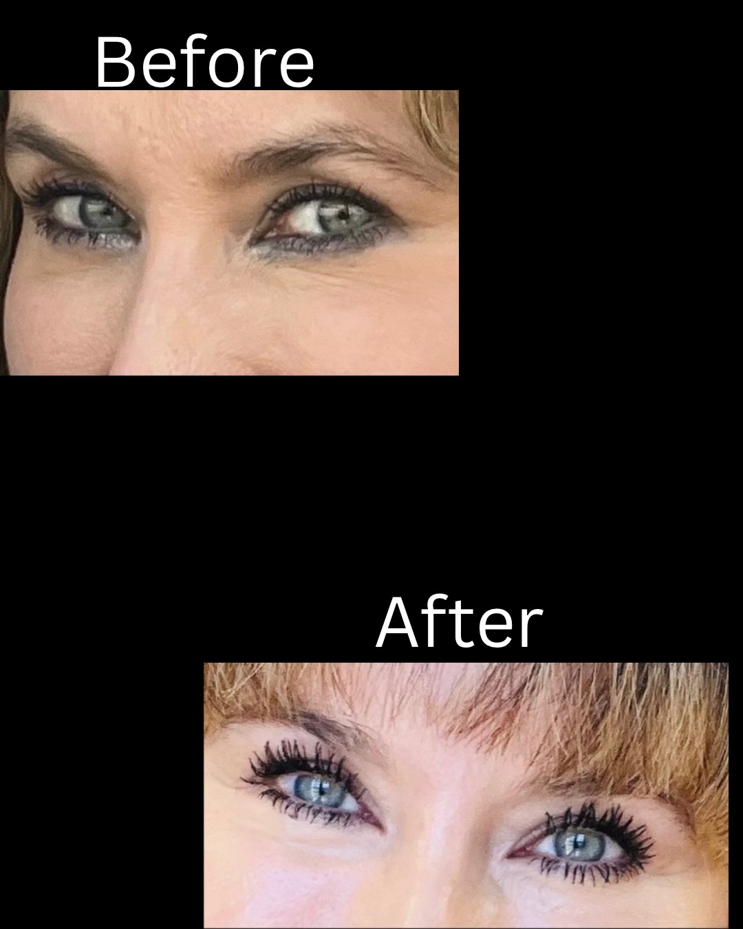 Eyelash Serum – Image 3