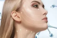 Cryo Neck Lift – Image 1