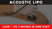 Acoustic Lipo (Cavi Lipo) Single Session – Image 3