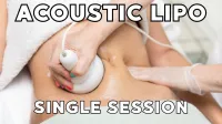 Acoustic Lipo (Cavi Lipo) Single Session – Image 4