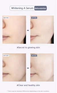 Whitening A Serum 50mL – Image 14