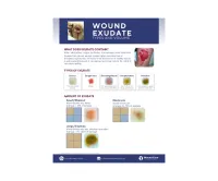 Guide: Wound Exudate Volume – Image 1